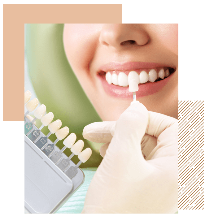 Nosprestations Pour Les Blanchiments Dentaires Ideal Clean DR Wemmel